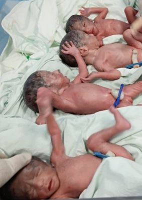 एक साथ 4 बच्चों का जन्म, डॉक्टरों की विशेष निगरानी में