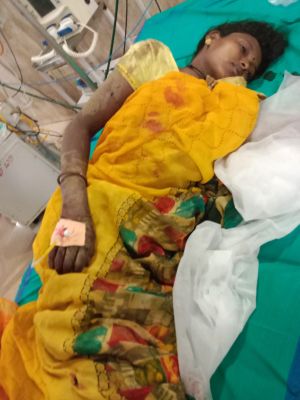 तेन्दूपत्ता तोड़ाई में जुटे मजदूरों पर जंगली सुअरों का हमला, आधा दर्जन गंभीर