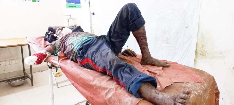 ढलान पर अनियंत्रित होकर ट्रक पलटा, ड्राइवर गंभीर