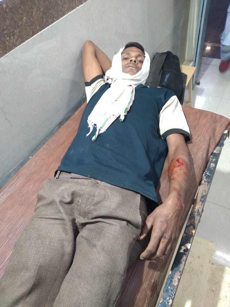 लकड़ी बीनने जंगल गए युवक पर भालू का हमला, जख्मी