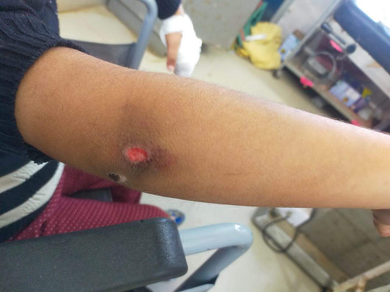 बुआ ने की भतीजी की पिटाई, चाइल्ड लाइन टीम ने बचाया