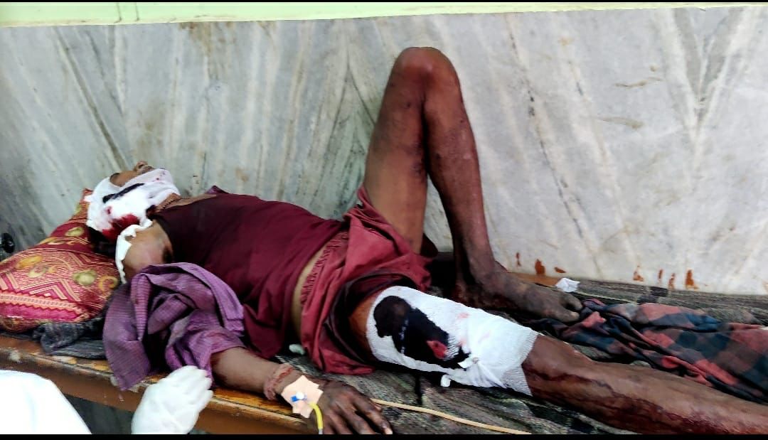 महुआ बीनते अधेड़ पर भालू ने किया हमला, गंभीर