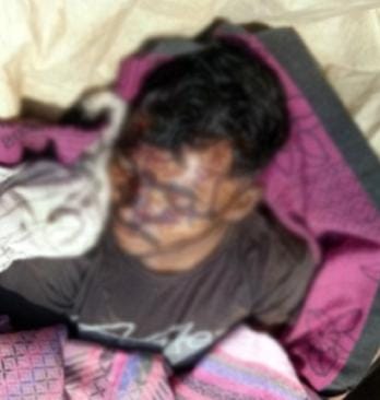 गढ़चिरौली में समर्पित नक्सली समेत दो की नक्सल हत्या