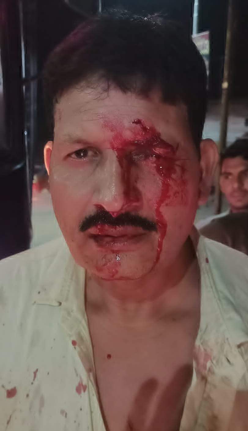 बीच रास्ते में बस रुकवा युवक ने चालक को पीटा, जुर्म दर्ज