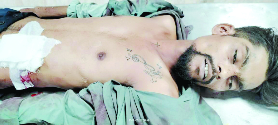  युवक पर चाकू से हमला, मौत