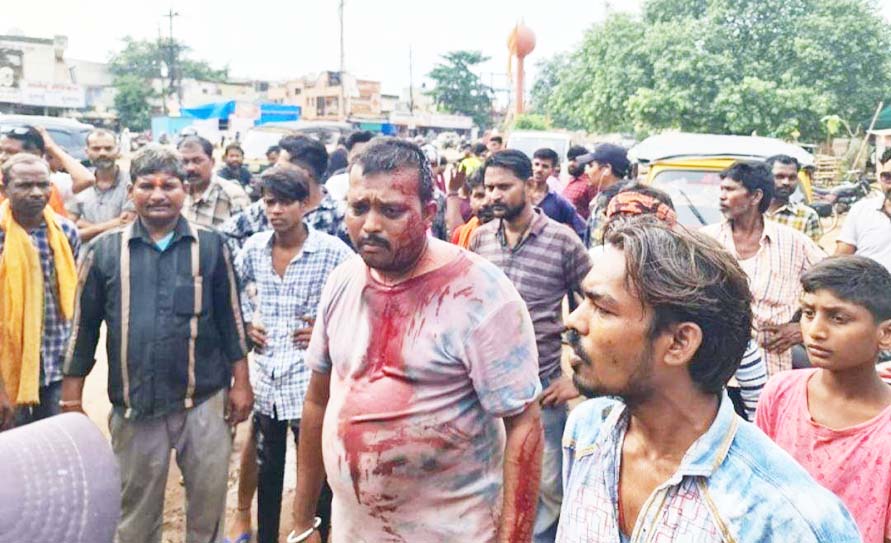 नशे में डंडा लहराते आते-जाते सभी को मार रहा था, कई राहगीर घायल नशे में डंडा लहराते आते-जाते सभी को मार रहा था, कई राहगीर घायल