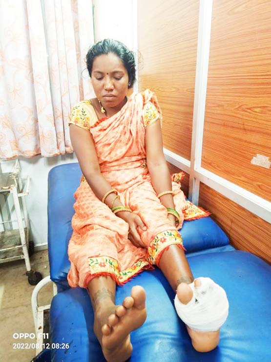 भालू के हमले से महिला घायल खरसिया वन परिक्षेत्र की घटना