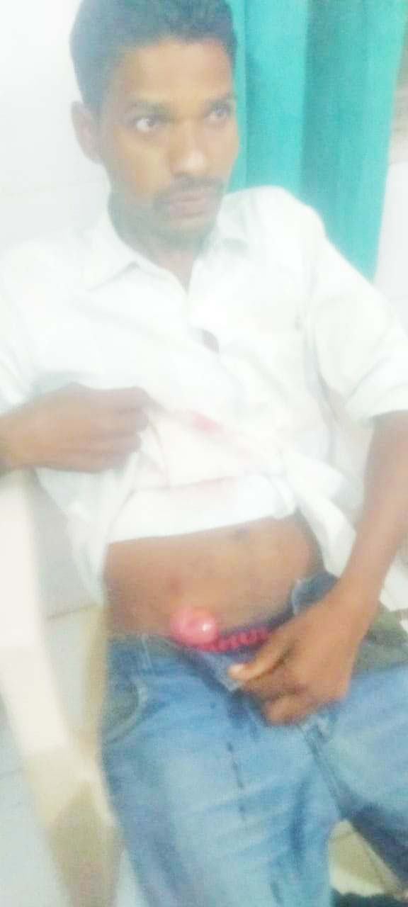  घर लौटते युवक पर चाकू से हमला, आरोपी गिरफ्तार