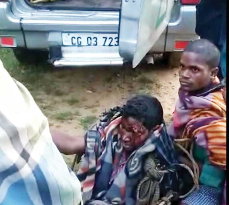 भालू से जान बचाने संघर्ष करता ग्रामीण खाई में गिरा, गंभीर