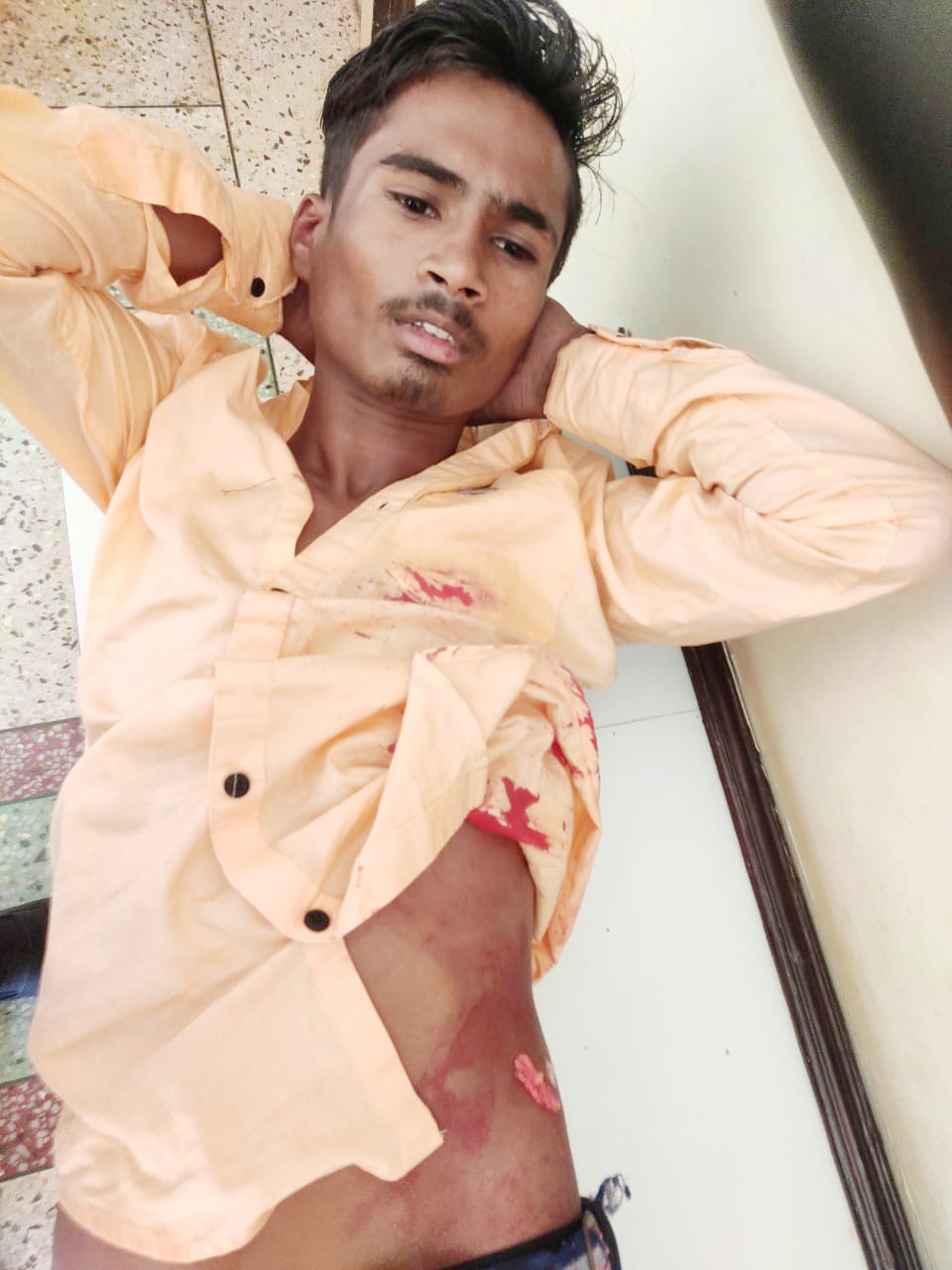 3 बदमाशों ने युवक को दिनदहाड़े मारा चाकू, अस्पताल में भर्ती