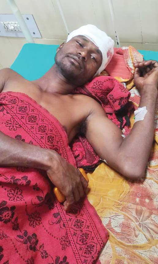 भालू ने किया ग्रामीण पर हमला, दोस्त ने बचाई जान