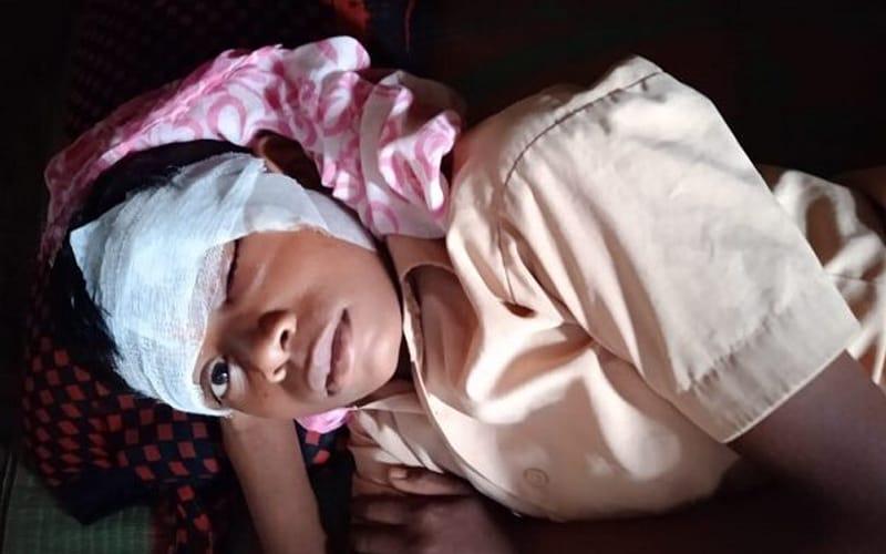 आरंग के भानसोज स्कूल में पंखा गिरने से छात्र घायल आरंग के भानसोज स्कूल में पंखा गिरने से छात्र घायल
