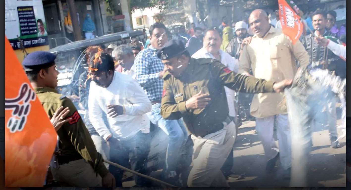 विधायक वोरा के जलते पुतले को पुलिस ने कार्यकर्ताओं पर फेंका, झुलसे