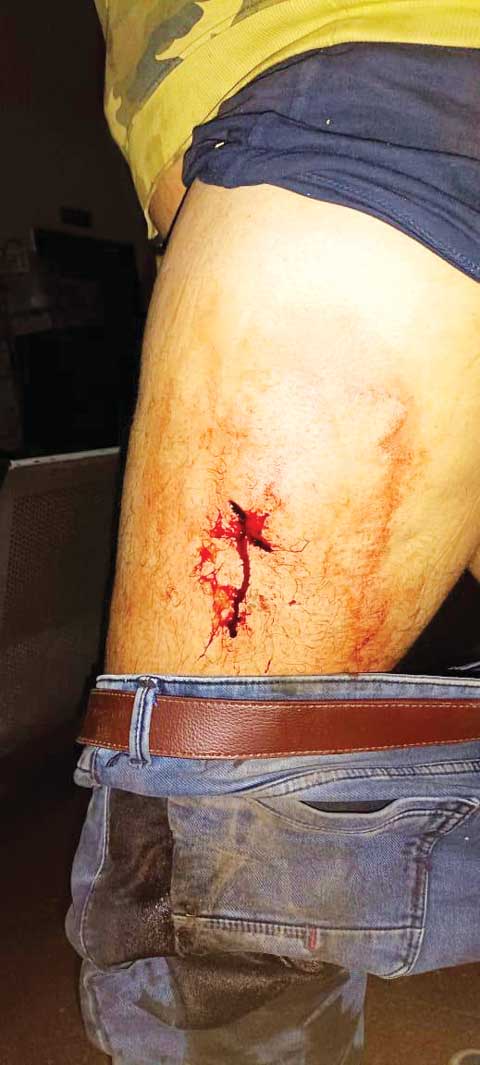 देर रात के गिरोहबाज कर रहे चाकूबाजी, तीन गिरफ्तार