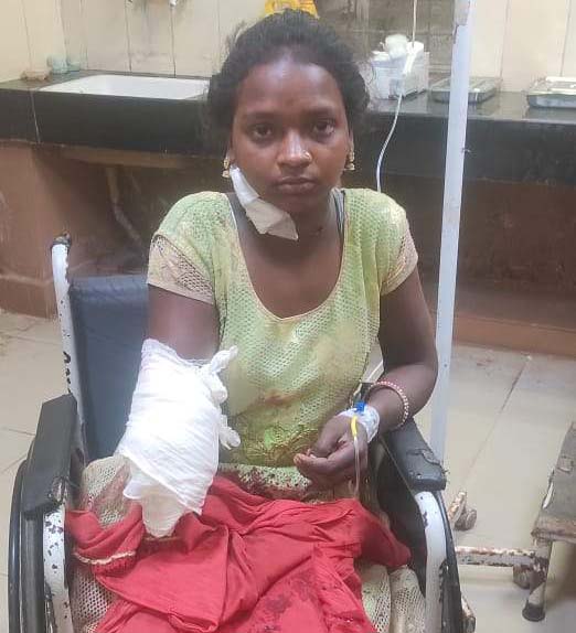 नाबालिग का हाथ मिक्चर मशीन में फंसा, कटकर अलग