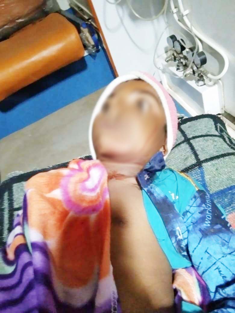 तेंदुए के हमले से बालक जख्मी, अस्पताल में तेंदुए के हमले से बालक जख्मी, अस्पताल में