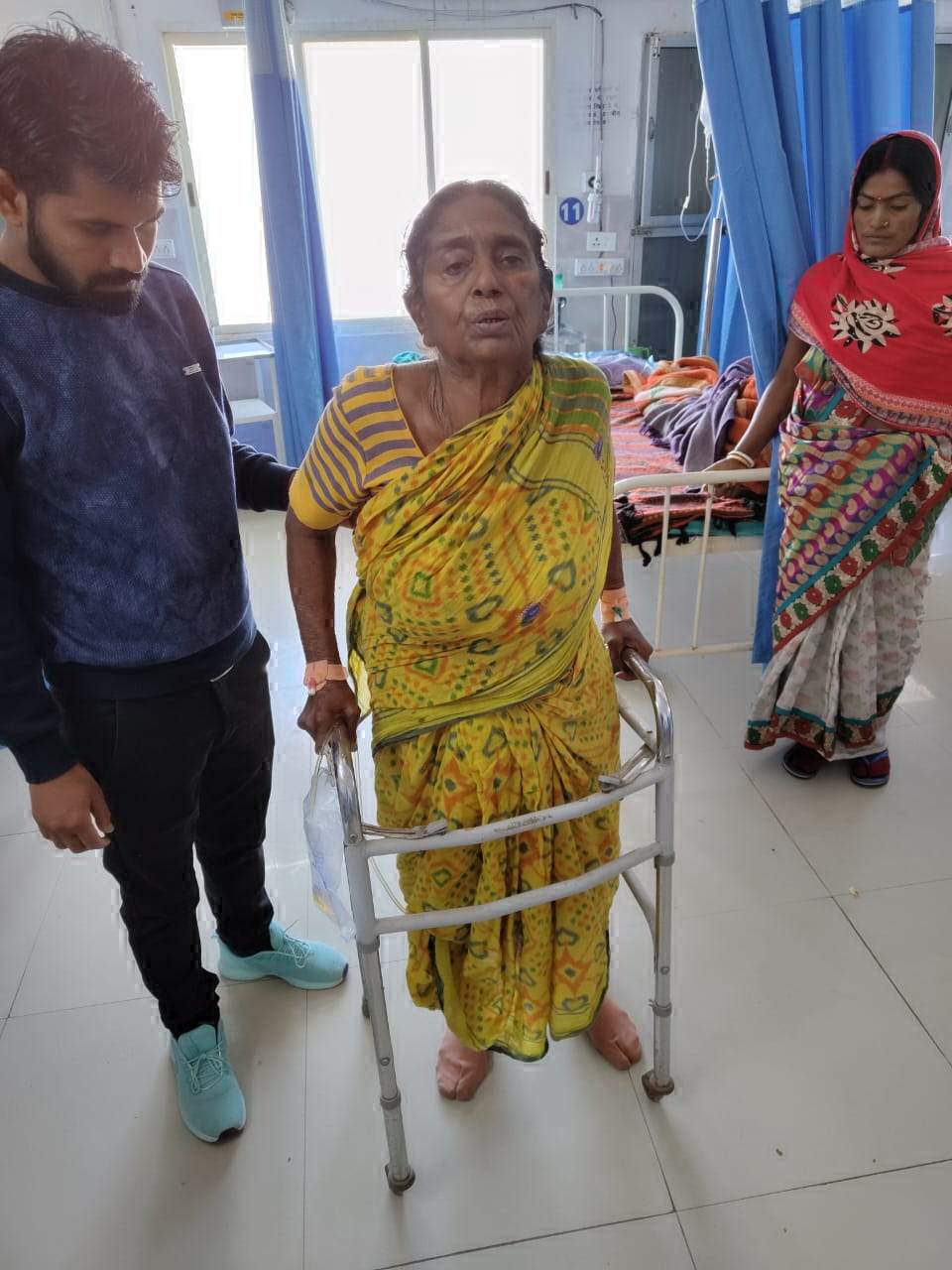 कूल्हा का प्रत्यारोपण कर 24 घंटे के अंदर महिला को पैरों पर खड़ा किया