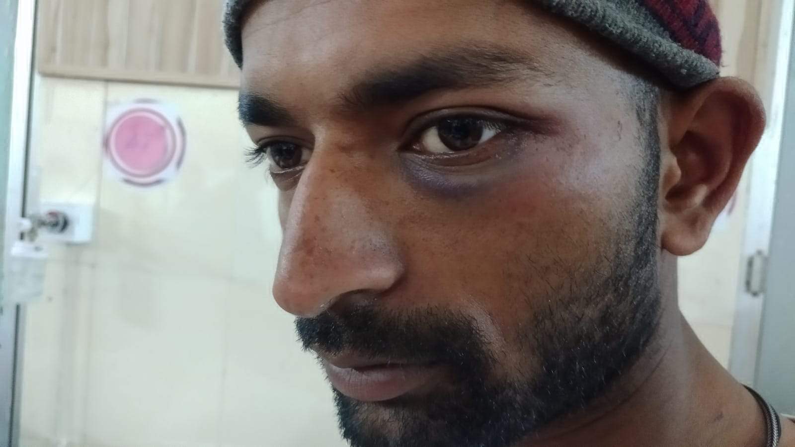 पुलिस पर जूतों-पट्टों से पीटने का आरोप, घायल युवक अस्पताल में