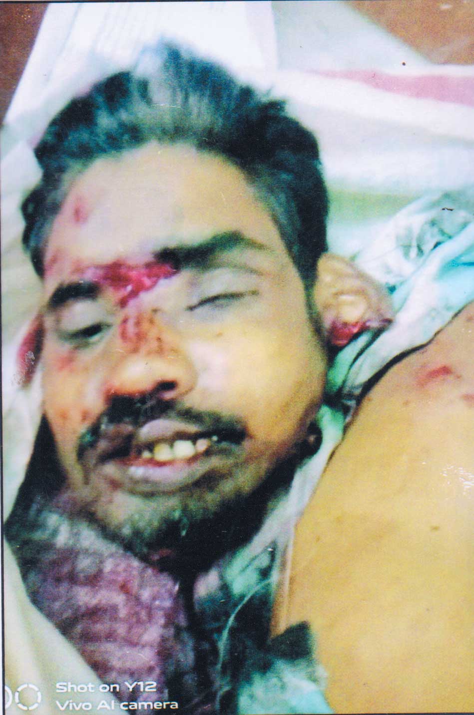 16 महीने पहले मिला अज्ञात शव पुलिस परिजनों की तलाश में