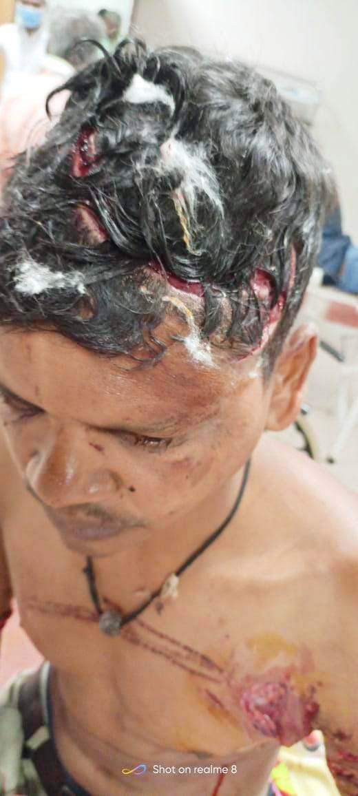 भालू ने ग्रामीण पर किया हमला, जख्मी