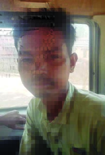 आंगन में सोये पड़ोसी पर टांगी से वार कर हत्या, आरोपी गिरफ्तार आंगन में सोये पड़ोसी पर टांगी से वार कर हत्या, आरोपी गिरफ्तार