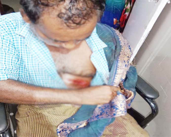 जंगली सुअर ने किया हमला, किसान दंपत्ति हुए घायल