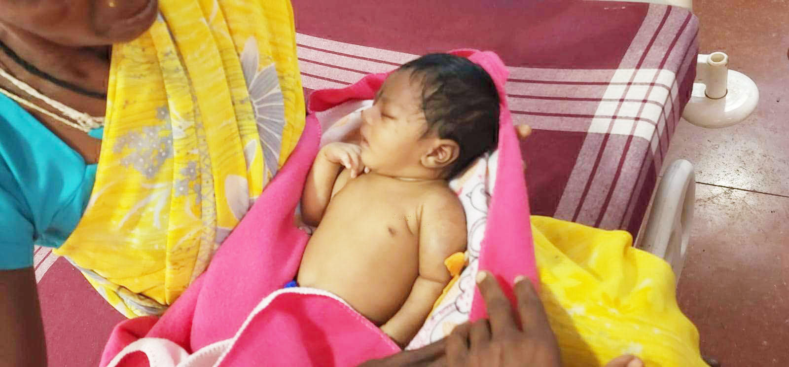 सिजेरियन डिलीवरी में शिशु का हाथ टूटा