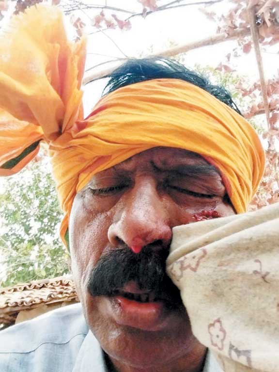  पुलिस पर पत्थर और पेट्रोल मशाल से हमला