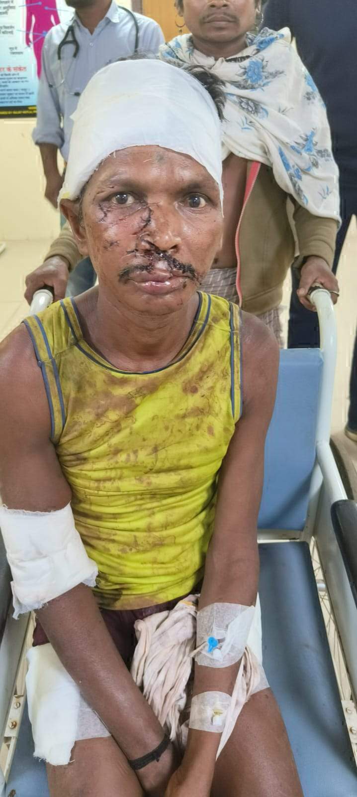 गए थे बैल खोजने, मिली मादा भालू शावकों के साथ  ग्रामीण पर किया हमला, कुत्ते ने बचाई जान