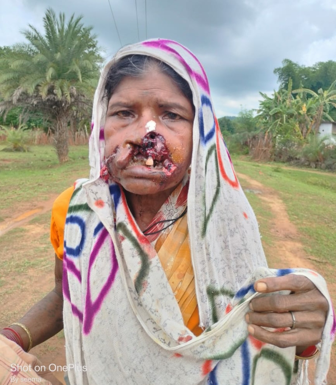 बुजुर्ग महिला पर अज्ञात जानवर ने किया सोते समय हमला