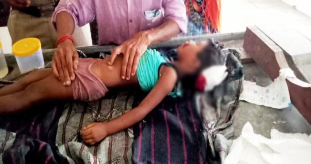 मकान मरम्मत के दौरान खेलते हुए बच्ची पर गिरी दीवार, मौत