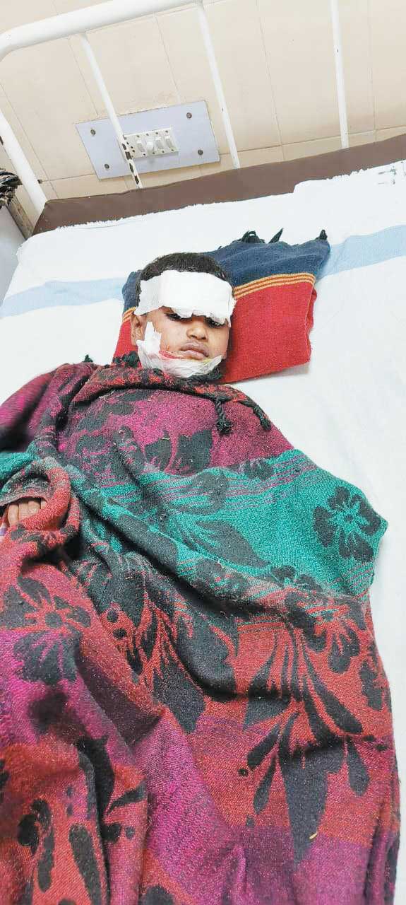 पागल कुत्ते ने किया बच्चे पर हमला, मां ने जान पर खेल बचाई जान