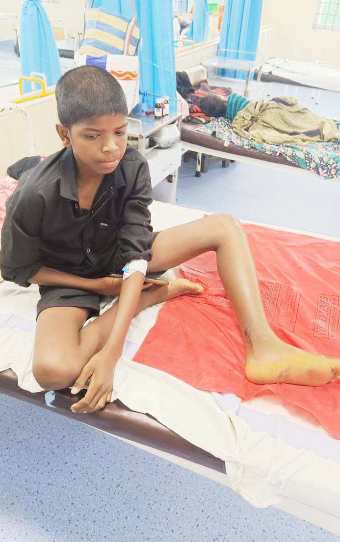 मेकाज के डॉक्टरों ने दिया सर्पदंश के 10 मरीजों को जीवनदान