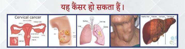 निशुल्क कैंसर जांच एवं परामर्श शिविर