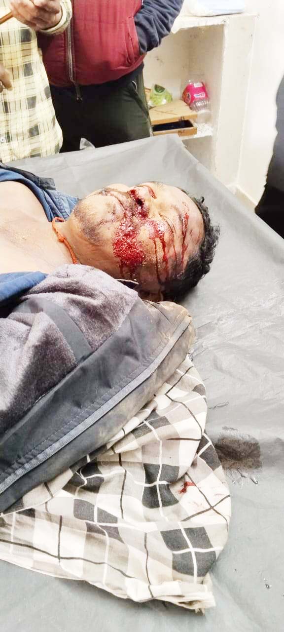 बाइक के साथ पुल से गिरे, पिता की मौत, पुत्र घायल बाइक के साथ पुल से गिरे, पिता की मौत, पुत्र घायल