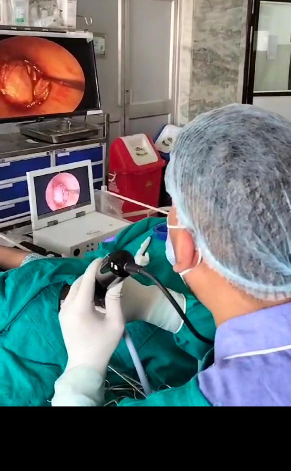 दूरबीन पद्धति से कान  का सफल ऑपरेशन