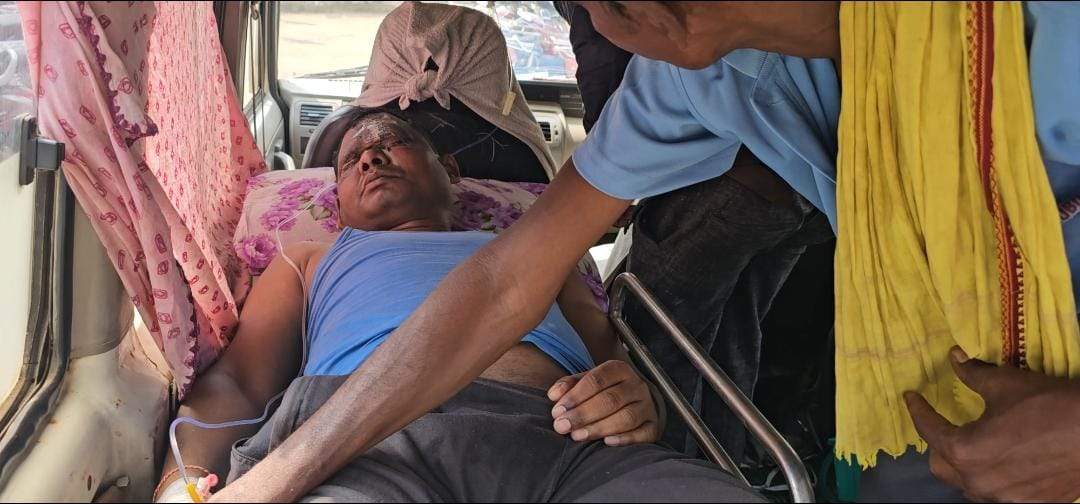 बिजली तार की चपेट में सरकारी कर्मी घायल, रायपुर भेजा बिजली तार की चपेट में सरकारी कर्मी घायल, रायपुर भेजा