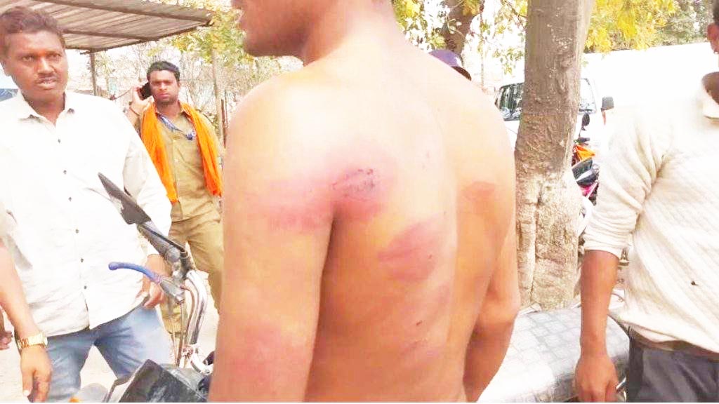  राइस इंडस्ट्री के संचालकों की दबंगई, वाहन चालक - साथियों को बेरहमी से पीटा