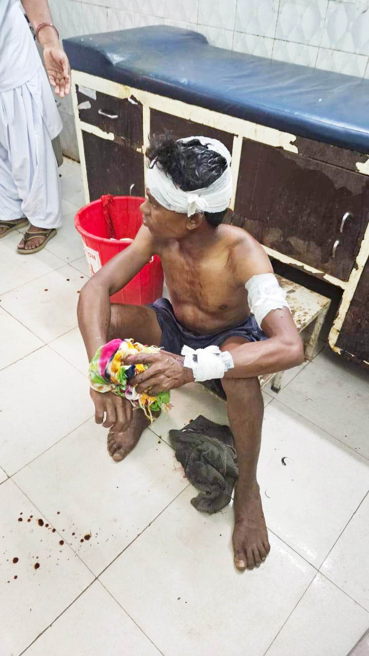 कुत्ते ने निभाई वफादारी, मालिक पर तेंदुए ने किया हमला, बचाने भिड़ गया