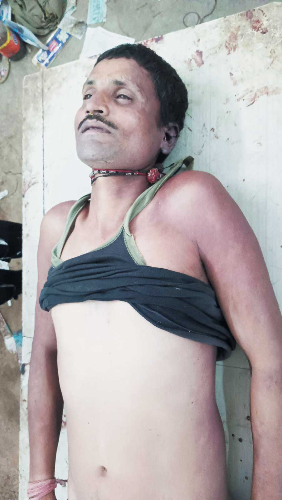 सर्प दंश से युवक की मौत