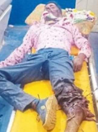 बाइकों में टक्कर,  दो घायल