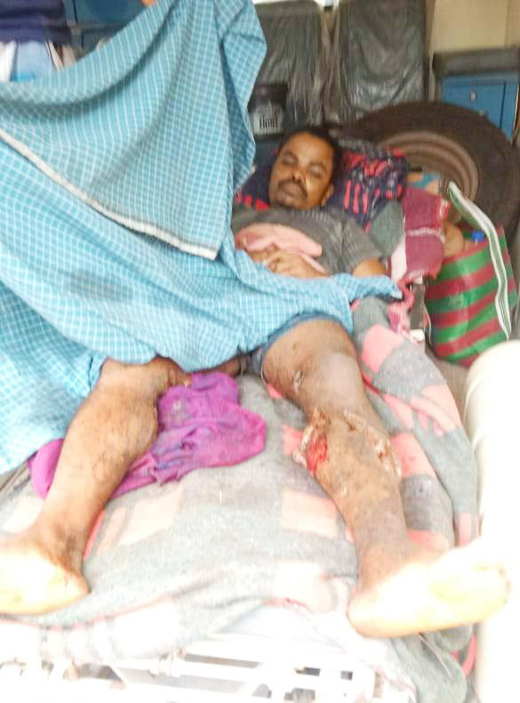 आईईडी विस्फोट में भाई-बहन घायल