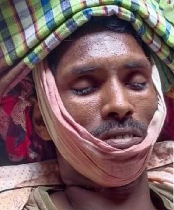 नक्सली की हत्या 