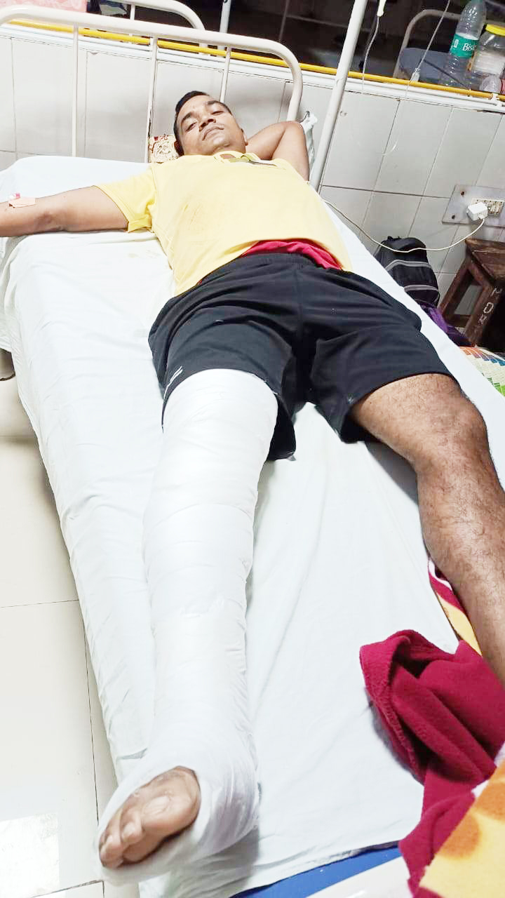 खराब सडक़ पर सिपाही गिरा परिवार समेत पैर फैक्चर, पत्नी-बच्चे सुरक्षित खराब सडक़ पर सिपाही गिरा परिवार समेत पैर फैक्चर, पत्नी-बच्चे सुरक्षित