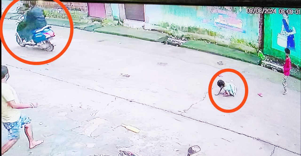 सडक़ किनारे खेल रही मासूम स्कूटी की ठोकर से घायल