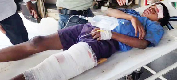 ट्रक की चपेट में छात्रावास अधीक्षक की मौत, दो बच्चे गंभीर ट्रक की चपेट में छात्रावास अधीक्षक की मौत, दो बच्चे गंभीर