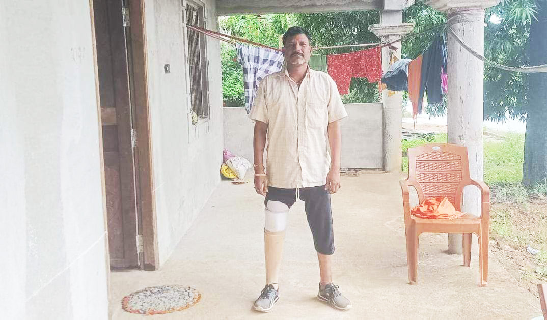 सडक़ दुर्घटना में एक पैर गंवा चुके नंदकुमार को मिला कृत्रिम पैर