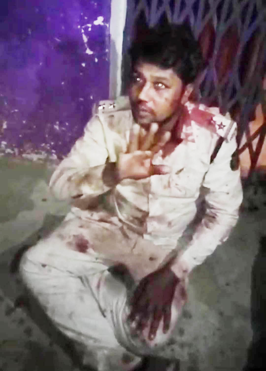 वन विभाग की टीम पर हमला, अफसर का फूटा सिर वन विभाग की टीम पर हमला, अफसर का फूटा सिर
