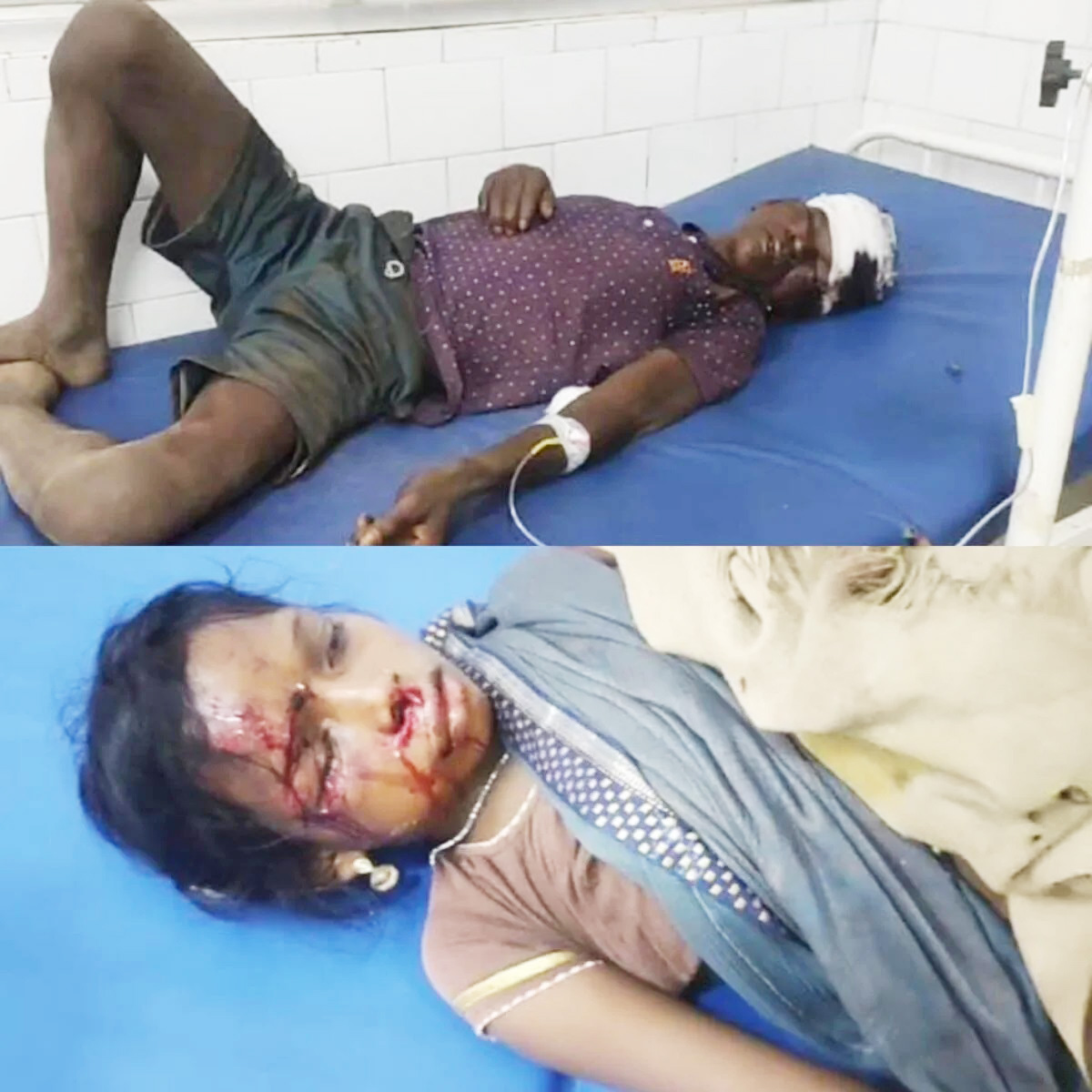 भालू के हमले में मजदूर गंभीर घायल, परिजनों के साथ भी हादसा