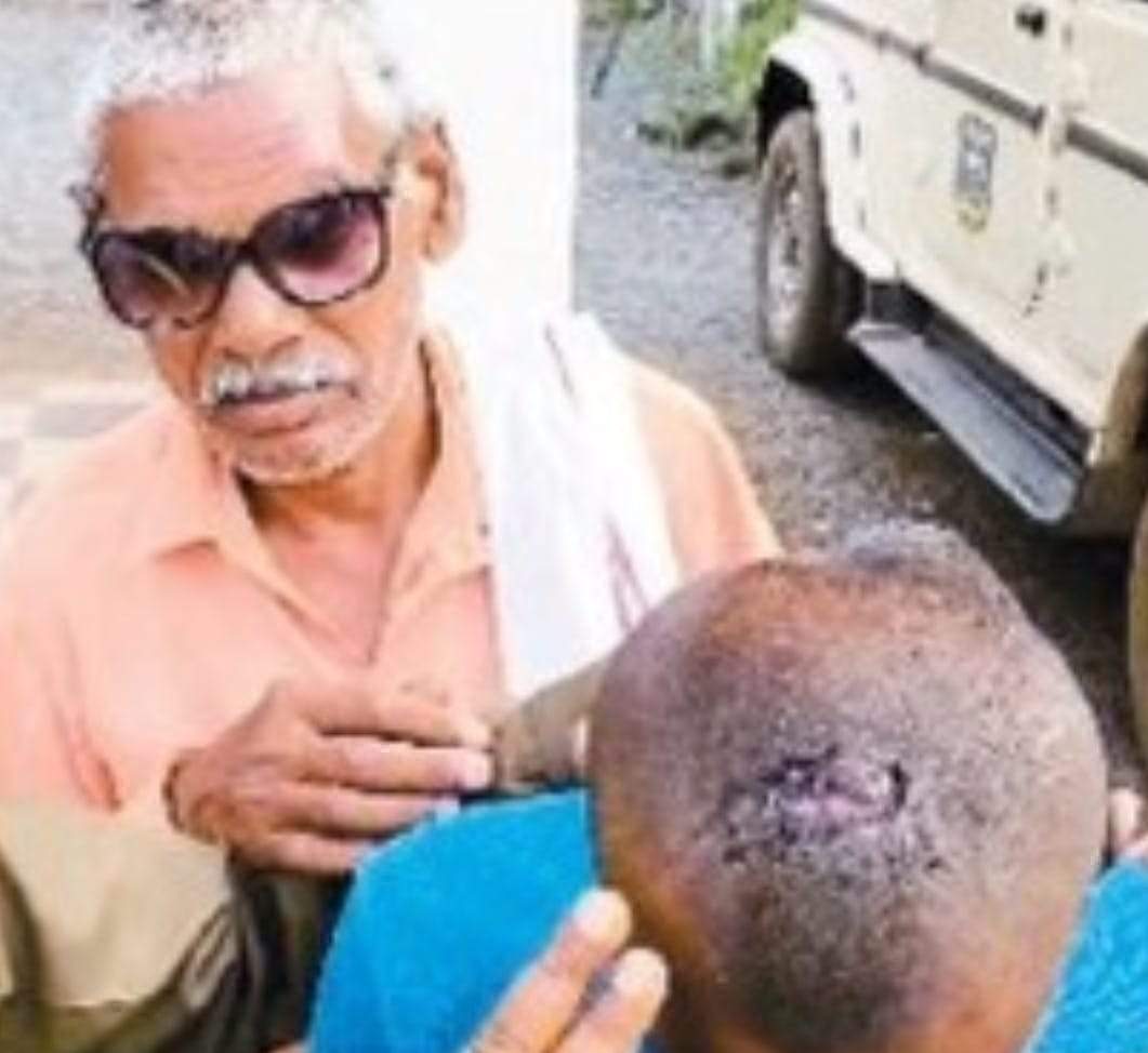 विधायक पुत्र ने आदिवासी युवक पर किया हमला